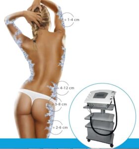 cryo 21 pilt